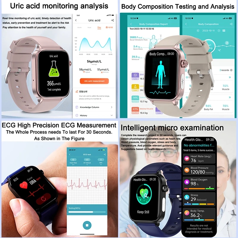 2025 Baru Untuk XIAOM1 ECG+PPG - Smartwatch New Watches For Women ulasan dan harga